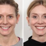 How the Best Doctors in Dubai Improve Facial Contours