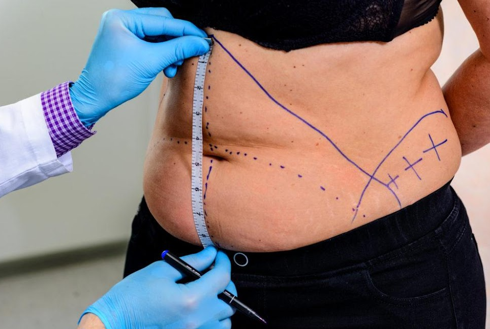 Top Plastic Surgery Procedures Offered at Tampa Palms Plastic Surgery