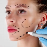 The Most Popular Cosmetic Surgery Procedures and What They Involve