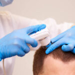 Hair Loss Treatment Trends Popular in Riyadh Today