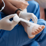 Everything You Need to Know About Bunion Correction