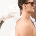 Laser Hair Removal in Dubai: Achieving Lasting Results