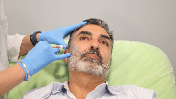 Sculptra Fillers: A Revolutionary Approach to Facial Rejuvenation in Riyadh