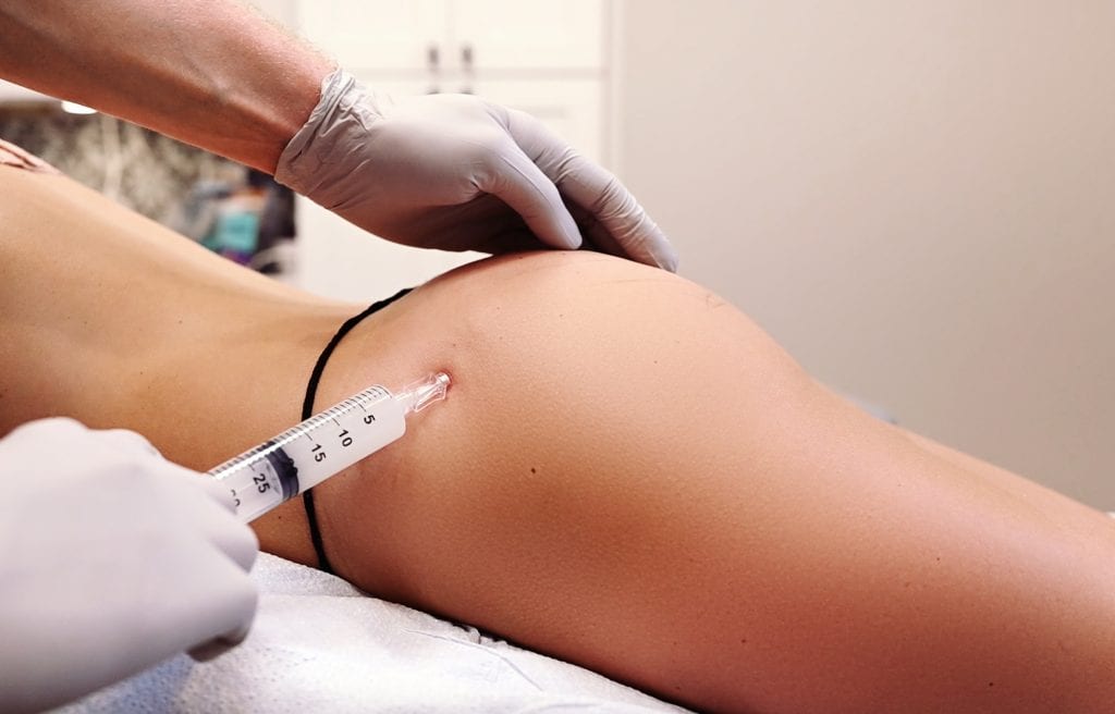 Can Butt Fillers Enhance Your Confidence Naturally?