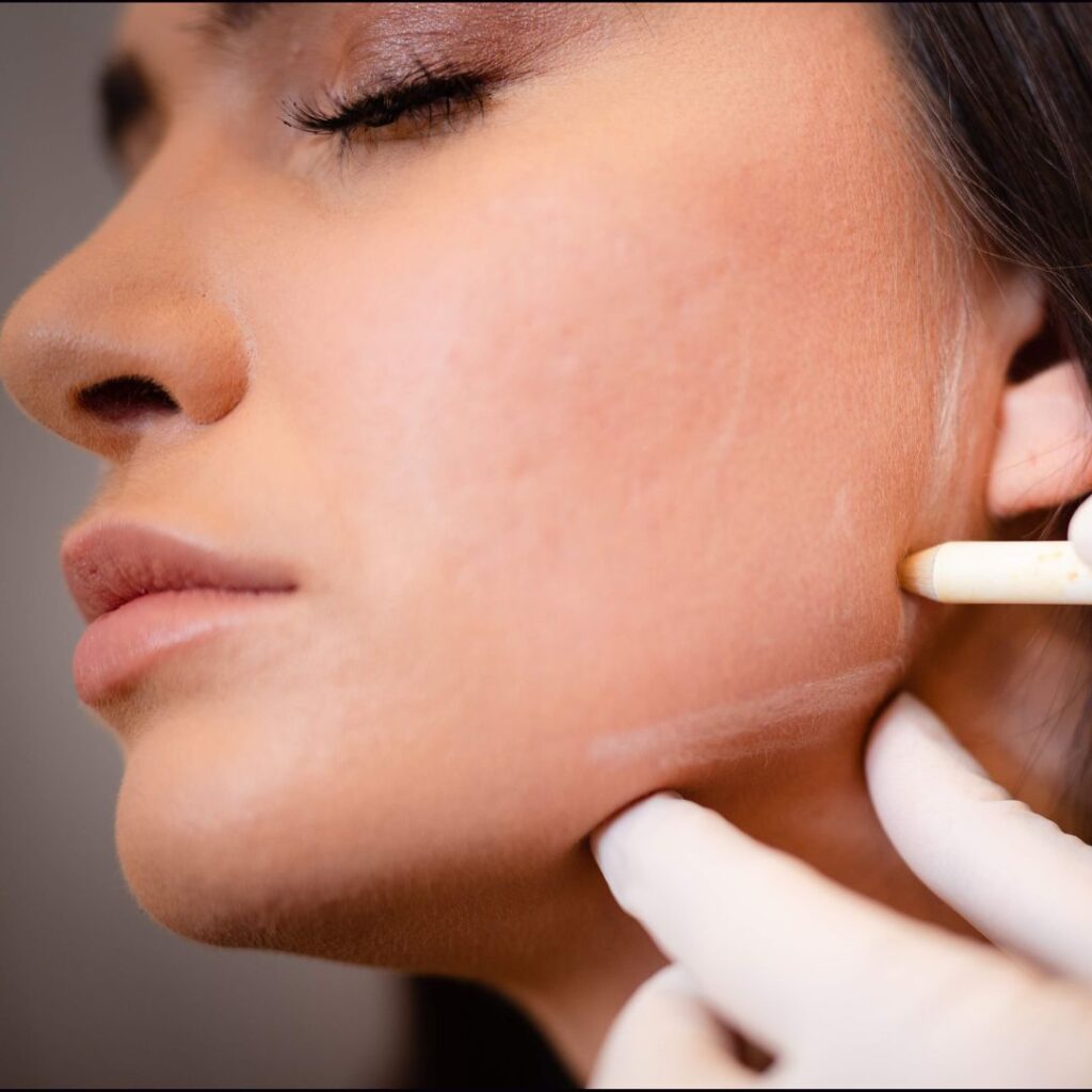 Mastering Facial Harmony: Dermal Fillers in Dubai