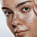 Pigmentation Treatment in Dubai: Modern Skin Brightening Solutions