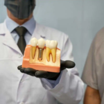 Dental Implants vs Dental Bridges: Which Is Better for Replacing Missing Teeth?
