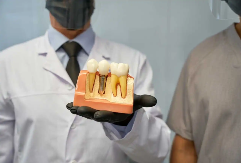 Dental Implants vs Dental Bridges: Which Is Better for Replacing Missing Teeth?