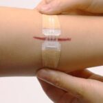 How Advanced Wound Closure Is Reshaping GCC Surgery