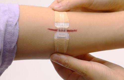 How Advanced Wound Closure Is Reshaping GCC Surgery
