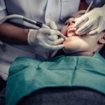 How Bone Density Influences the Choice Between All-on-4 and All-on-6
