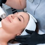 Is Pico Laser Treatment Worth Trying for Clear Skin?