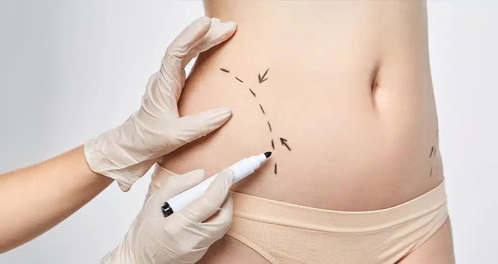 Body Contouring in Dubai: How It Helps Improve Body Shape and Proportion