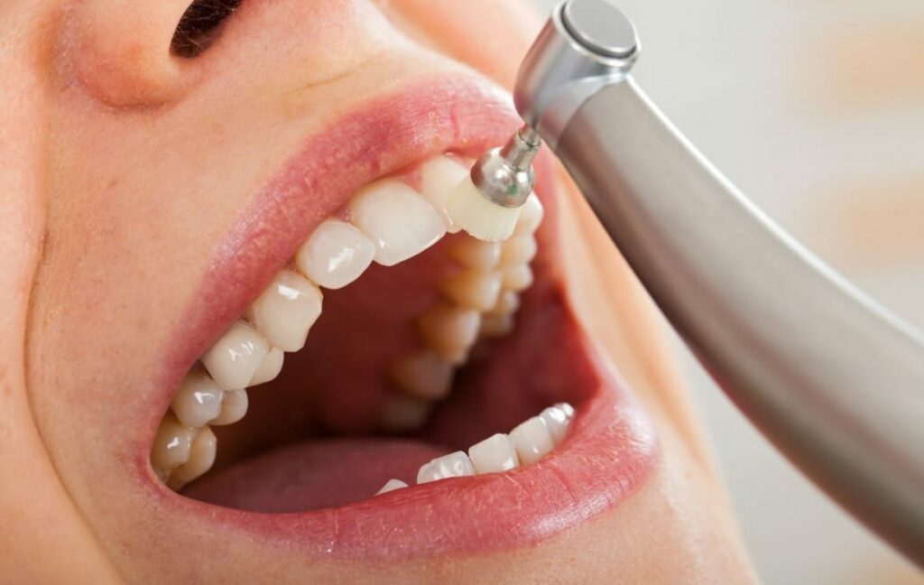 Teeth Cleaning and Scaling in Navi Mumbai: Understanding the Difference Between Routine Cleaning and Deep Scaling