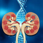 Understanding FSGS: Signs, Symptoms, and Treatment for Better Kidney Health