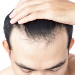 Advanced Clinics Offering Hair Replacement in Dubai