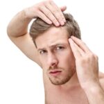 How to Build a Healthy Hair Care Routine After a Hair Transplant