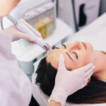 HydraFacial Treatment for Blackheads and Congested Pores