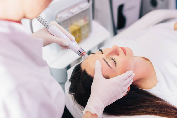HydraFacial Treatment for Blackheads and Congested Pores
