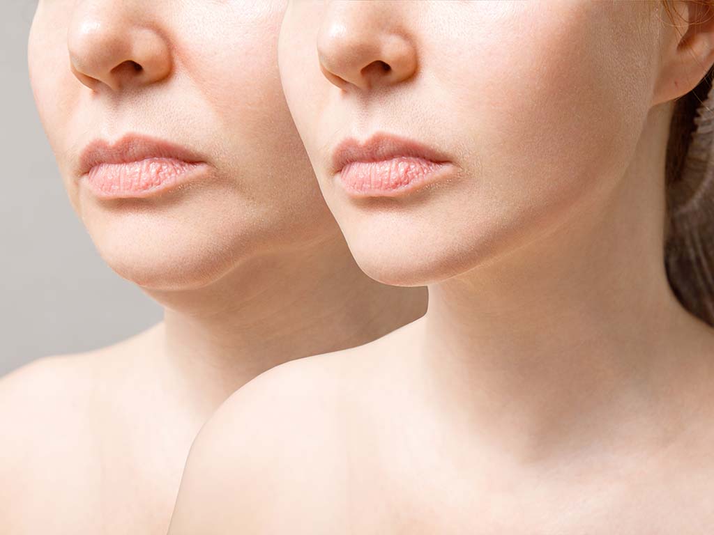 Preserving a Commanding Executive Presence Through Dermal Fortification