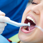 Root Canal Specialist in Chandigarh | RK Dental Practice