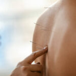 Experience Holistic Healing with Acupuncture Sonoma CA and Chinese Medicine Sonoma California by Healing Way Acupuncture Experts