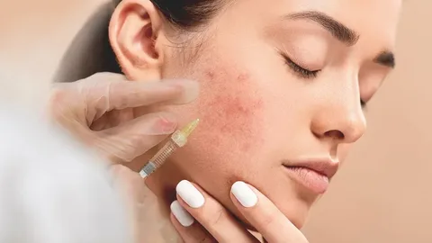 Pimple treatment in Dubai: Advanced Solutions