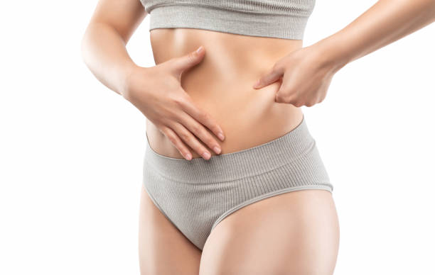 Tummy Tuck for Diastasis Recti: How Muscle Repair Makes a Difference