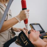 Microneedling Tretman U Cazinu – Vodič Za Zdraviju I Obnovljenu Njegu Kože