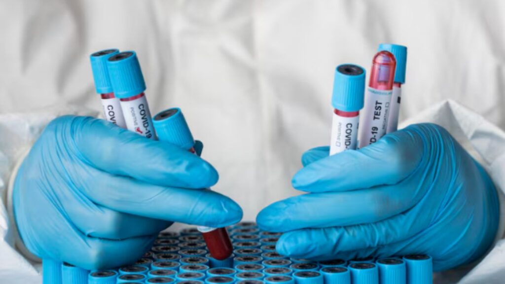 Rapid Diagnostic Testing Solutions You Can Trust with Atlantic Medical Supplies
