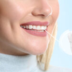 From Teeth Cleaning to Dental Implants: Understanding Your Dental Treatment Options