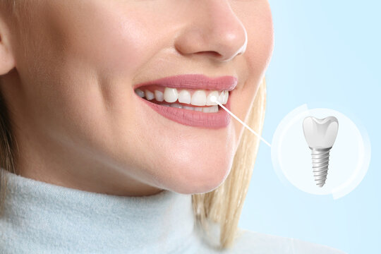 From Teeth Cleaning to Dental Implants: Understanding Your Dental Treatment Options