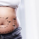The Root Causes of Post-Pregnancy Body Changes: Why Diet Alone Isn’t Enough