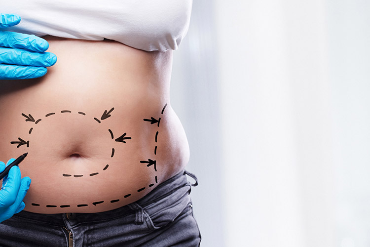 The Root Causes of Post-Pregnancy Body Changes: Why Diet Alone Isn’t Enough