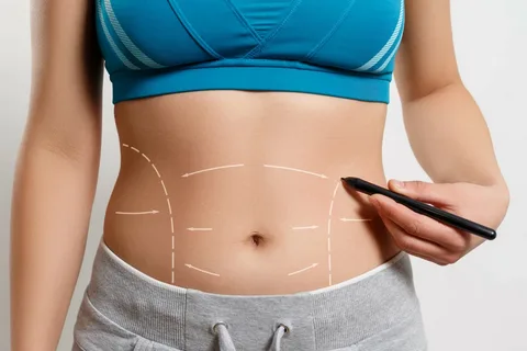 Tummy Tuck in Dubai: Transform Your Body