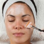 Does PCA Peel Treatment Help Reduce Acne Marks?