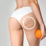 Non Surgical Butt Lift in Dubai: Firm and Lifted