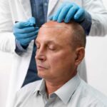 Medical Centers Offering Scalp Micropigmentation Dubai