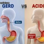 Acidity vs GERD: How to Know When You Need a Gastroenterologist in Ahmedabad