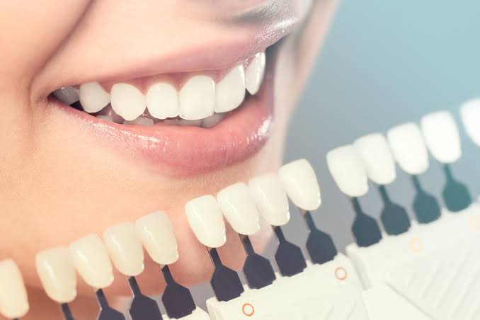 Common Smile Problems Cosmetic Dentistry Can Fix