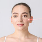 Understanding the Effects of Back Acne on Skin Appearance