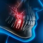 Emergency Tooth Pain: When Should You See an Endodontic Specialist in Houston, TX?