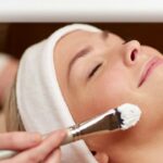 Can Chemical Peels Reduce Acne Scars Effectively?