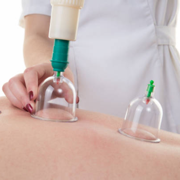 Cupping Therapy Treatment for Pain Relief in Haryana