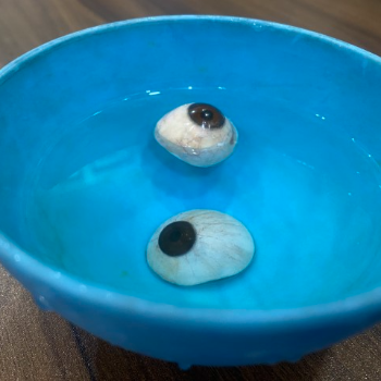 Transforming Lives: How Hollow Prosthesis Eyes Bring Hope to Many