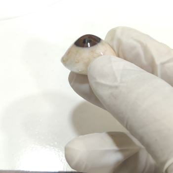 Transforming Lives: How Custom Prosthetic Eyes Empower Individuals to Embrace Their Unique Journey