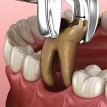 Best Dental Clinic in Bikramganj, Bihar – Your Smile Deserves Expert Care | MODERN ORAL AND DENTAL CLINIC