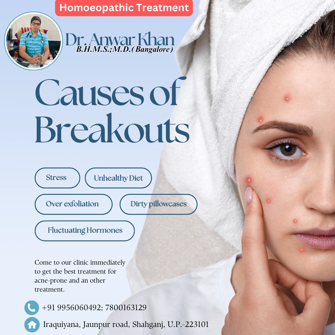 Acne-prone homoeopathic treatment