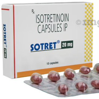 SOTRET 20-https://s3.ap-south-1.amazonaws.com/prod-media-vyaparify-com/vcards/products/226625/product_1747128891_6823123bd581a.png Image