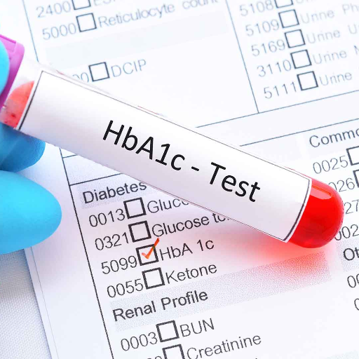 HBA1C BLOOD TEST-https://s3.ap-south-1.amazonaws.com/prod-media-vyaparify-com/vcards/products/370465/product_1759506897_68dff1d1cc4f0.png Image